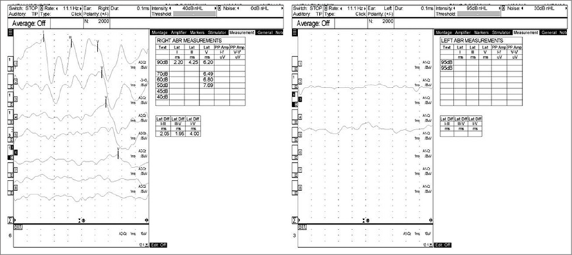 jcohns-30-1-105-g2