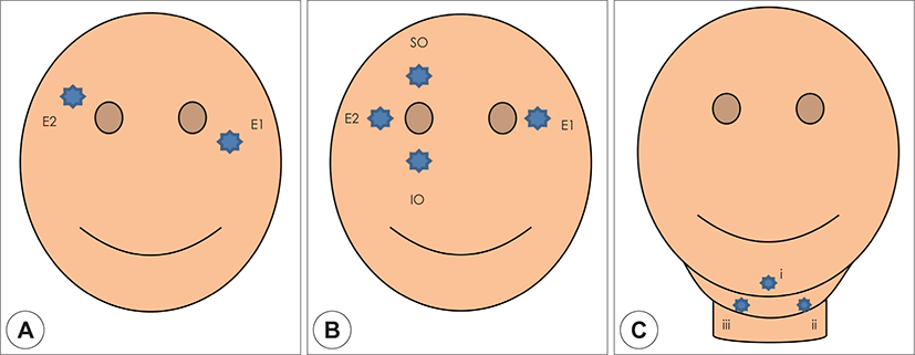 jcohns-30-1-5-g2