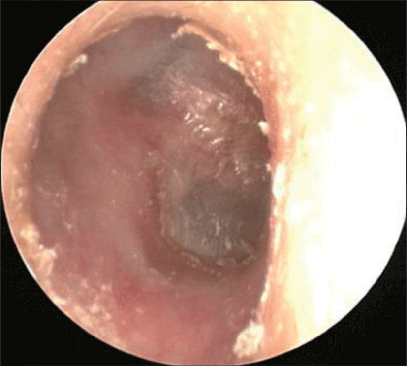 jcohns-30-2-199-g2