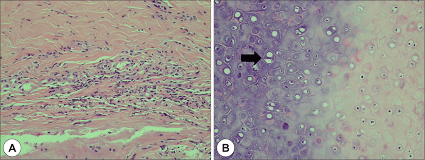 jcohns-32-3-245-g5