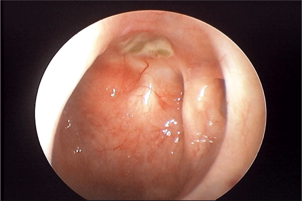 jcohns-33-3-144-g4