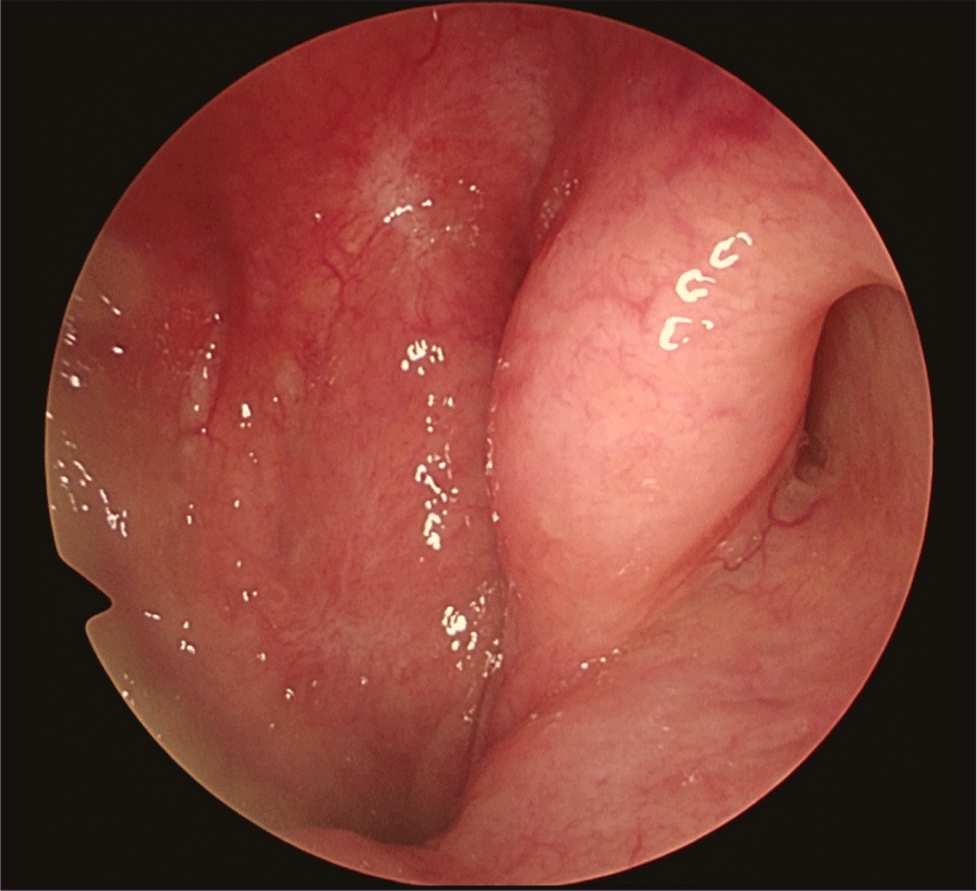 jcohns-33-3-149-g4