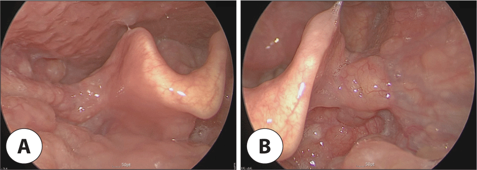 jcohns-33-3-159-g4