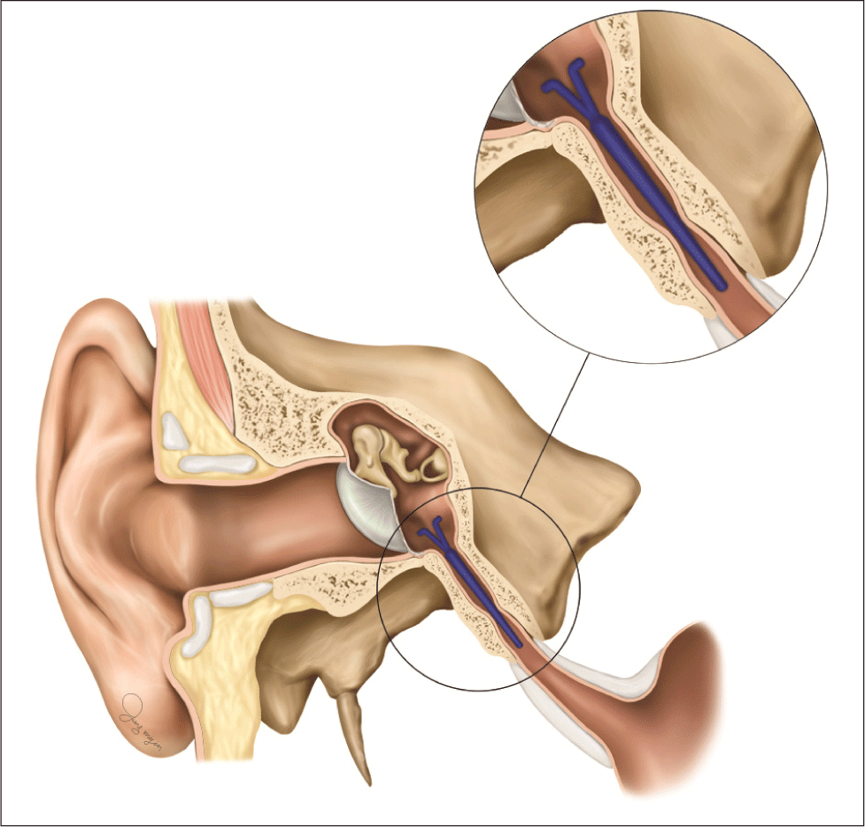 jcohns-33-4-184-g4