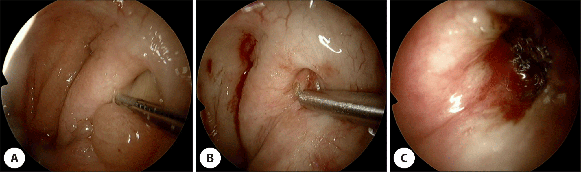 jcohns-33-4-223-g3