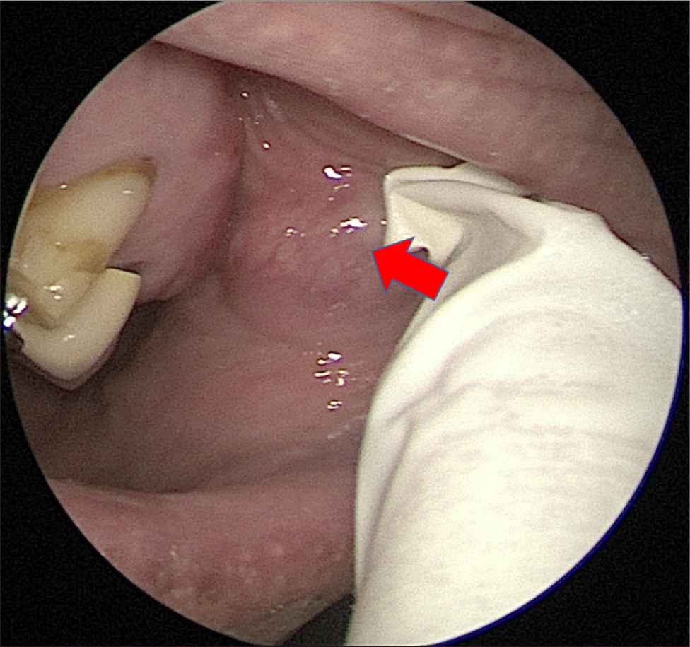 jcohns-33-4-246-g1