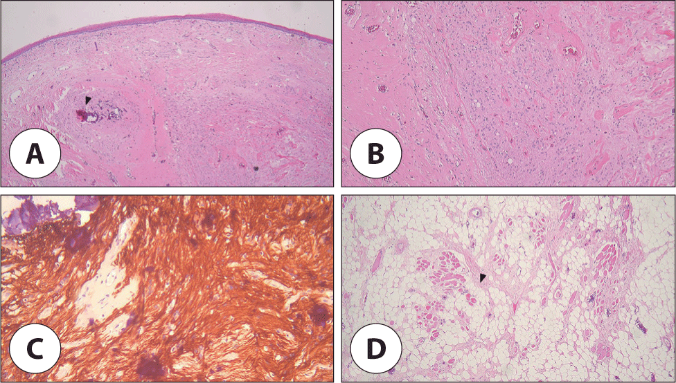 jcohns-34-4-173-g4