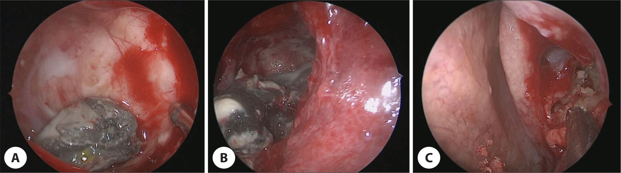 jcohns-34-4-205-g3