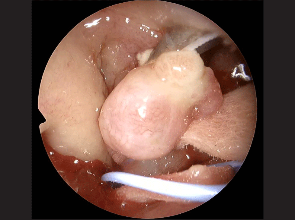 jcohns-34-4-231-g3