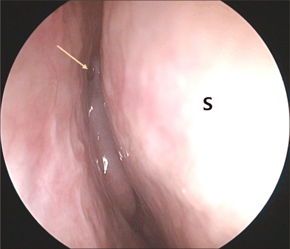 jcohns-37-3-119-g4